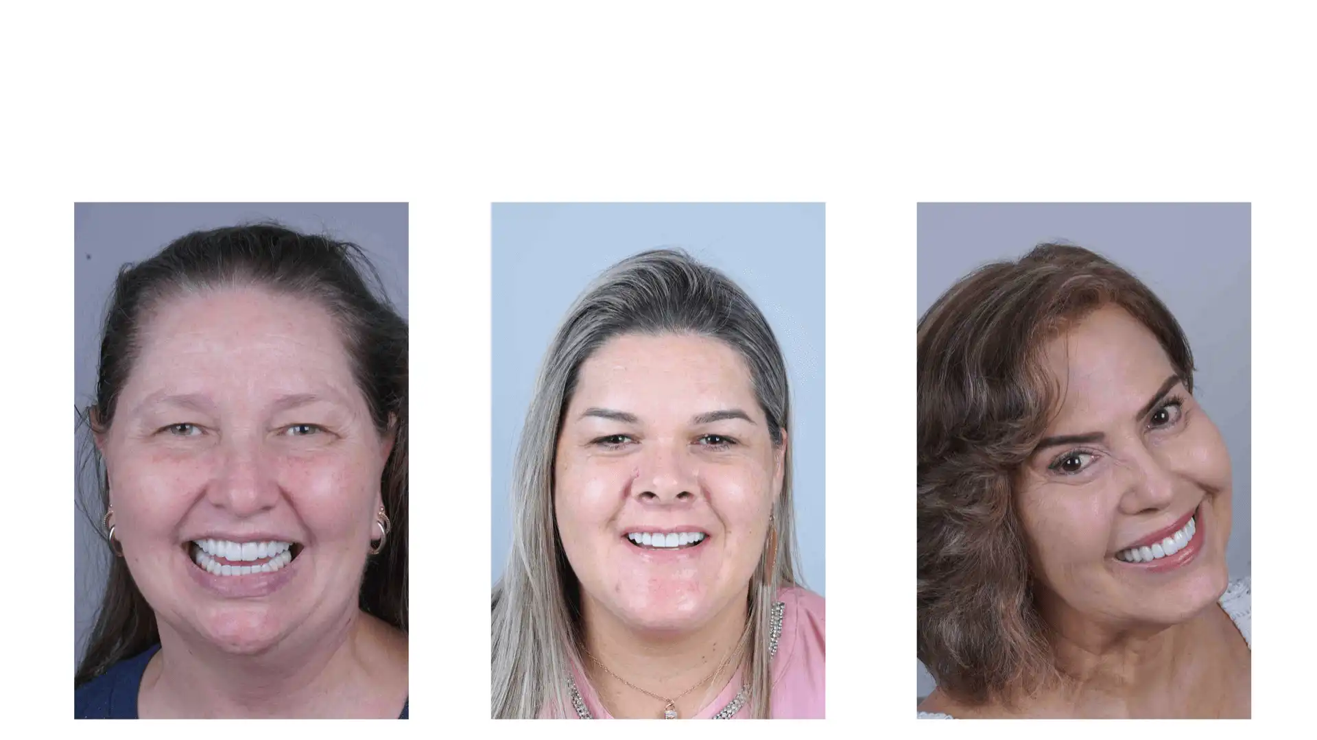 Paciente com dentes perfeitos 1